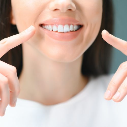 Close up image of woman pointing to her straight white teeth